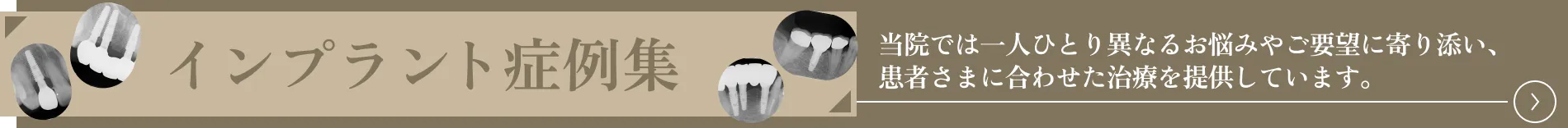 いちば歯科医院　インプラント症例集はこちら