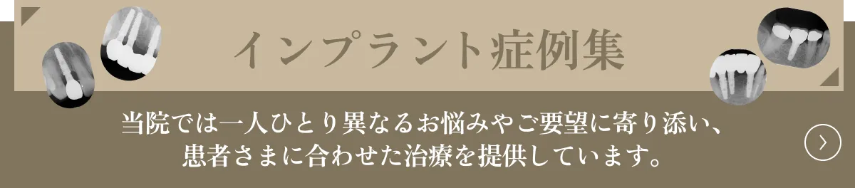 いちば歯科医院　インプラント症例集はこちら
