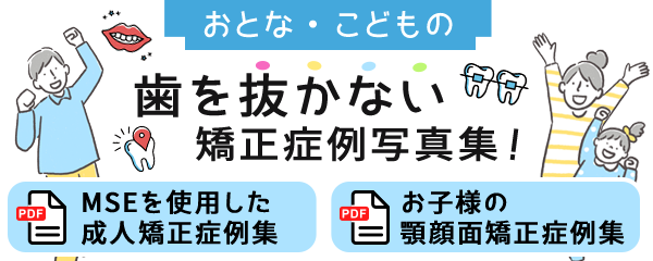 おとな・こどもの歯を抜かない　矯正症例写真集