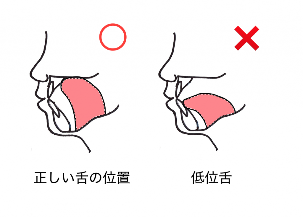 舌 の 位置 顔つき